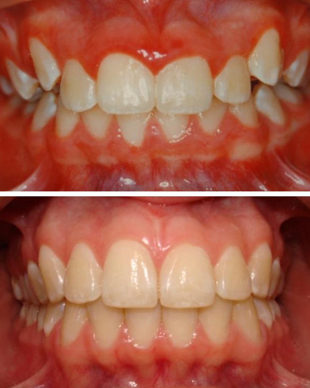 Antes e Depois - Clinica Dal Molin1